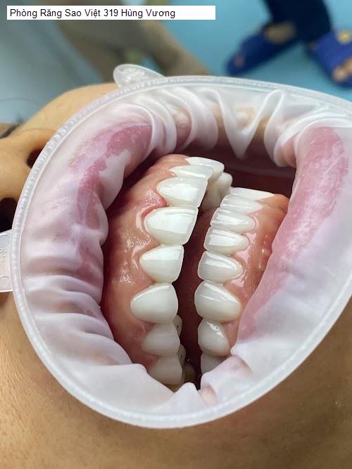 Hình ảnh Phòng Răng Sao Việt 319 Hùng Vương